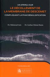 Un aperçu sur le décollement de la membrane de descemet compliquant la phacoémulsification | Mahmoud, Anis