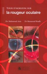 Tour d'horizon sur la rougeur oculaire | Mahmoud, Anis. Aut