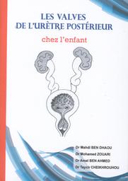 Les valves de l'urètre postérieur chez l'enfant | Ben  Dhaou, Mahdi. Aut