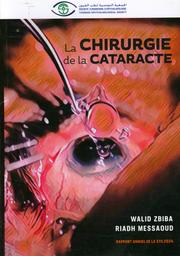 La chirurgie de la cataracte | Zbiba, Walid. Drt